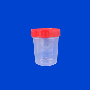 Gobelet à urine médical Wantong 120 ml en PP de qualité supérieure pour la collecte d'échantillons - Product Image 2