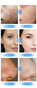 Popular 11in1 Co2 Bubble Jet Peel Hydra Beauty Facial Machine O2 Pure Music Oxygen Dome O2 Derm Facial Machine Portable - Product Image 4