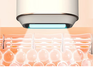 Dispositivo de depilación de zafiro de punto de congelación certificado por la FDA, uso doméstico, depilación de cuerpo completo, unisex - Product Image 5