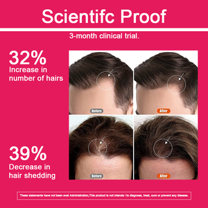 Tabletas de crecimiento del cabello de etiqueta privada OEM ODM para mujeres vitamina C biotina promueve el cabello saludable nutrir píldoras de suplemento - Product Image 3