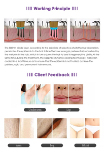 2026 Permanent Hair Removal <b>Machine</b> 3 Wavelength 790nm 808nm 1060nm Hair Removal Remover Home Use Device - Product Image 4