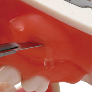 Modèle dentaire <span class=keywords><strong>maxillaire</strong></span> bilatéral pour la pratique de l'incision de la <span class=keywords><strong>kyste</strong></span> et de l'élimination du pur - Product Image 5