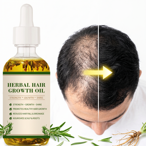 Huile Essentielle Capillaire aux Extraits Végétaux, Mélange de Plusieurs Extraits de Plantes pour Soigner <span class=keywords><strong>le</strong></span> Cuir Chevelu et les <span class=keywords><strong>Racines</strong></span> des Cheveux - Product Image 4