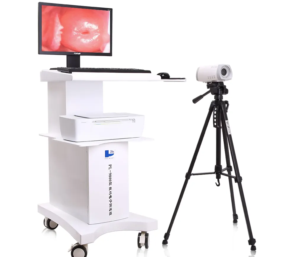 Arabası dijital kolposkop taşınabilir dijital Video kolposkop jinekoloji jinekolojik klinik tanı aracı