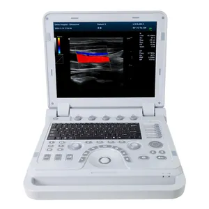 CONTEC CMS1700A Doppler de couleur humaine portable, système de Diagnostic à ultrasons, machine à ultrasons numérique