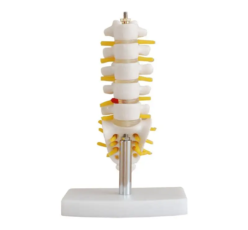 Mini Lumbar Vertebrae with Sacrum & Coccyx and Herniated Disc Medical and biological teaching aid Anatomical model