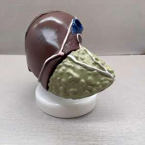 Modèle de Pathologie du Cancer du Foie avec Base - Spécimen Pédagogique d'Hépatologie - Product Image 5