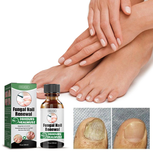EELHOE Loción nutritiva para reparación <span class=keywords><strong>de</strong></span> <span class=keywords><strong>uñas</strong></span> grises, solución hidratante para el cuidado <span class=keywords><strong>de</strong></span> <span class=keywords><strong>las</strong></span> <span class=keywords><strong>uñas</strong></span>, que ilumina y suaviza <span class=keywords><strong>las</strong></span> <span class=keywords><strong>uñas</strong></span> - Product Image 2
