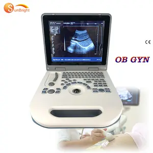 Gravidez humana da máquina do ultrassom B/2B/4B/M dos instrumentos médicos do ultrassom do portátil