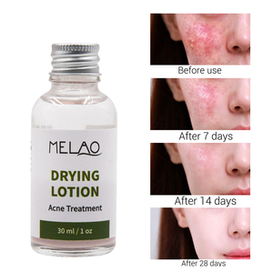 Melao 30ml thảo dược tự nhiên chống mụn trứng cá mặt huyết thanh tốt nhất mụn trứng cá khô Lotion mụn mụn loại bỏ huyết thanh mặt sửa chữa - Product Image 4