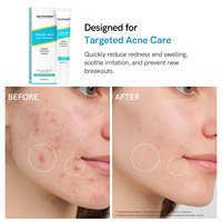 Gel anti-acné à l'acide salicylique pour le visage, hydratant et apaisant, contrôle du sébum, soin doux BHA, marque privée