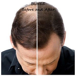 Fibras Capilares Orgánicas Bunee en Aerosol para Engrosar el Cabello, Aplicador en Spray, OEM - Product Image 4