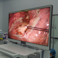 Système d'imagerie 4K avancé TU-402 pour usage hospitalier, images haute résolution, procédures chirurgicales précises, interventions mini-invasives