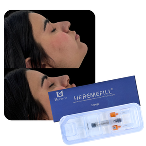 Inyector de Ácido Hialurónico <span class=keywords><strong>para</strong></span> Nariz y <span class=keywords><strong>Labios</strong></span>, Jeringa <span class=keywords><strong>para</strong></span> Relleno Dérmico HA, Pluma de Ácido Hialurónico <span class=keywords><strong>para</strong></span> Relleno Dérmico de Nariz y <span class=keywords><strong>Labios</strong></span> - Product Image 5