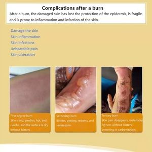 Envío gratis Huatuo Burn Scald Ungüento Eliminar la pudrición muscular Anti-infección Promueve la curación de la piel - Product Image 5