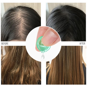 Capsule per la Crescita dei <span class=keywords><strong>Capelli</strong></span> all'Ingrosso, Vegane e Naturali, con <span class=keywords><strong>Olio</strong></span> di Rosmarino e Vitamina E, Trattamento Antiforfora e Nutriente - Product Image 4
