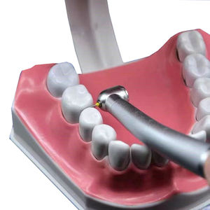 Snelle Tandheelkundige Diamanten Burs Set Voor Interproximale Emailreductie Elektrische Stroombron Ce Gecertificeerd Klasse Ii 20000Rpm - Product Image 5