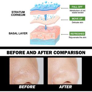 <span class=keywords><strong>Masque</strong></span> <span class=keywords><strong>Peel</strong></span> <span class=keywords><strong>off</strong></span> Marque privée Hommes Visage Soins de la peau Beauté Nettoyage en profondeur des pores Points noirs Charbon de bambou <span class=keywords><strong>Masque</strong></span> noir pour le visage - Product Image 6