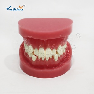 Modèle anatomique orthodontique de malocclusion en PVC, modèle de formation dentaire - Product Image 2