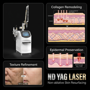 <span class=keywords><strong>Prix</strong></span> de la tige laser Nd:YAG à impulsions longues, Nd:YAG Q-switched 1064 nm, laser picoseconde pour l'élimination des tatouages et des sourcils, machine de beauté Nd:YAG - Product Image 1