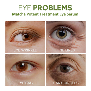 OEM Matcha Essence intensive de réparation crème anti-âge yeux anti-rides soulage la fatigue oculaire réduit les poches améliore les ridules - Product Image 6