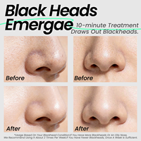 Bandes nasales nettoyantes en profondeur à la boue volcanique pour l'élimination des points noirs, masque facial minimisant les pores, patch nasal au charbon de bambou avec logo personnalisé