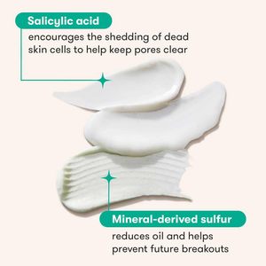 Lance Private Label - Tratamiento para el Acné de 3 Pasos, Limpiador Blanqueador, Suero, Hidratante Facial para Piel Sensible Propensa al Acné, Tamaño de Viaje - Product Image 3