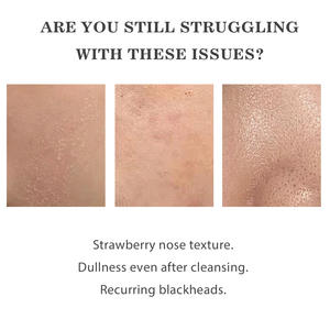 น้ำรำข้าวผสมไนอาซินาไมด์ แอมพูล ช่วยผลัดเซลล์ผิวอย่างอ่อนโยนและเผยผิวกระจ่างใส - Product Image 3