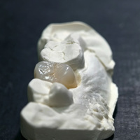 Nuevo Bloque de Zirconia Translúcida de Alta Dureza con Gradiente Natural del 43%-57% para Prótesis Dentales