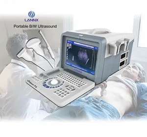 LANNX uRason P9 Neu entwickeltes voll digitales Ultraschall-Diagnose-Bildgebung system in Verbindung mit verschiedenen Sonden S/W-Ultraschall