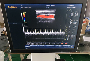 Système d'échographie Doppler couleur numérique complet CE JM-908A sur chariot, idéal pour des diagnostics complets, y compris abdominaux - Product Image 4