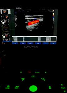 Ecógrafo Doppler Color Portátil para Hospital Veterinario, Mejor <span class=keywords><strong>Precio</strong></span>, Máquina <span class=keywords><strong>de</strong></span> Ultrasonido a Color 3D 4D - Product Image 4