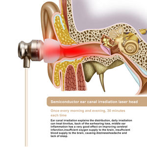 Interface USB type-c de dispositif d'oreille du <span class=keywords><strong>prix</strong></span> usine 650nm avec la boîte de stockage - Product Image 4