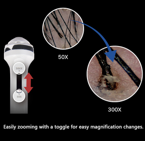 Máy phân tích tóc và da đầu cầm tay đa ngôn ngữ Full HD sản xuất tại Hàn Quốc - Product Image 4