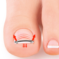 Attelle de Correction des Ongles en Acier Inoxydable 304, Bande Élastique Invisible Réutilisable pour Relever les Bords des Ongles, Soutien pour Ongles Incarnés