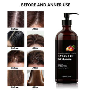 Champú Voluminizador con Aceite de Batana <span class=keywords><strong>para</strong></span> Cabello Fino y Graso - Engrosa <span class=keywords><strong>el</strong></span> Cabello, Controla la Grasa y la Caspa, Reduce <span class=keywords><strong>el</strong></span> <span class=keywords><strong>Frizz</strong></span> y Aporta Brillo - Product Image 3