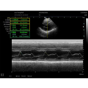 Ecógrafo a color E20 para uso veterinario, escaneo de cuerpo completo con sondas convexas, lineales y microconvexas, certificado CE - Product Image 1