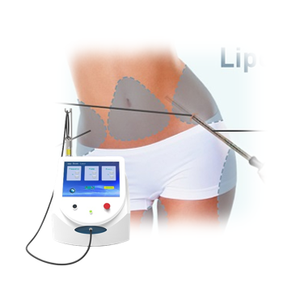 <span class=keywords><strong>Precio</strong></span> al por mayor con descuento, Láser de Diodo multifunción de 980nm, múltiples longitudes de onda, eliminación efectiva de hongos en las uñas, araña venosa - Product Image 6