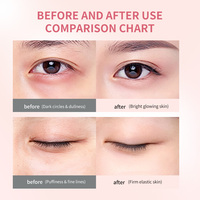 Masque Gel Hydrogel pour les Yeux Marque Blanche – Patchs Anti-Âge au Collagène et Acide Hyaluronique Hydratants et Éclaircissants – OEM ODM