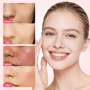 Crème nettoyante pour le visage au PDRN d'ADN de saumon, blanchissante, à l'acide salicylique, nettoyage en profondeur, resserrement des pores, apaisante, rafraîchissante, 100 ml, MOOYAM - Product Image 5