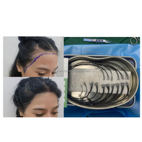 Machine de greffe de cheveux FUE sans rasage pour cheveux longs, kit de greffe de cheveux FUE sans cicatrices, micro-moteur, micro-aiguille
