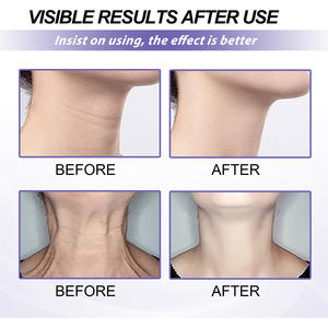 Oem Hidrolizado Colágeno Suavizante y Aclarador Líneas del Cuello Belleza Crema PARA EL Cuello Adultos Hidratante Cara Mujer Piel Hidratante - Product Image 4