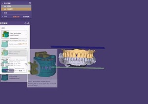 <span class=keywords><strong>EXO</strong></span> 3.2 3.1 3.0 <span class=keywords><strong>CAD</strong></span> Dental-Design-Software Unterstützung Bitte wenden Sie sich vor dem Kauf an den Kundendienst - Product Image 2