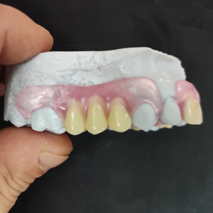 Dentiers amovibles Valplast, prix du laboratoire dentaire en Chine, dentiers flexibles en acrylique, dentiers amovibles RPD avec dents artificielles en acrylique - Product Image 1