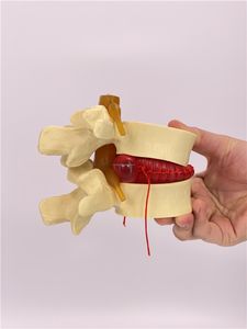 Modèle anatomique éducatif de colonne vertébrale lombaire en PVC pour la maladie des disques intervertébraux humains - Product Image 3