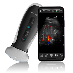 Scanner de ultrassom sem fio, android, wifi, connect held, mini cor, cabeça dupla, ultrassônico - Product Image 2