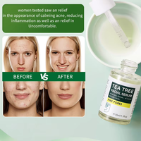Sérum Visage Arbre à Thé Marque Blanche OEM – Traitement Anti-Acné, Contrôle du Sébum, Minimisation des Pores – Formule et Emballage Personnalisés