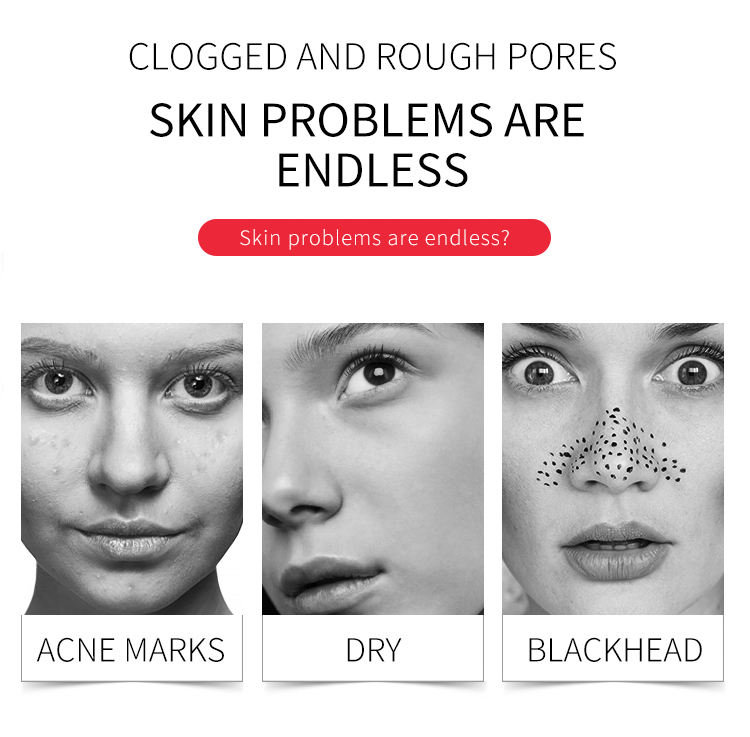 DR RASHEL AHA BHA Miracle Renewal Skin Care Set OEM Facial Care Kit