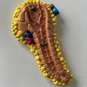 Modelo de Enseñanza de Ciencias Médicas, Patología Humana, <span class=keywords><strong>Diabetes</strong></span>, Anatomía <span class=keywords><strong>en</strong></span> PVC para Escuelas de Medicina - Product Image 5