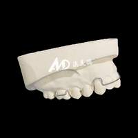 Aligneur dentaire à ressort amovible pour la correction des dents |   Appareil de rétention orthodontique